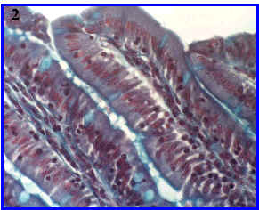 epitelio monoestratificado prismtico con microvellosidades y clulas caliciformes