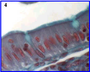 epitelio monoestratificado prismtico con microvellosidades y clulas caliciformes