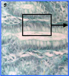 epitelio monoestratificado prismtico con microvellosidades y clulas caliciformes