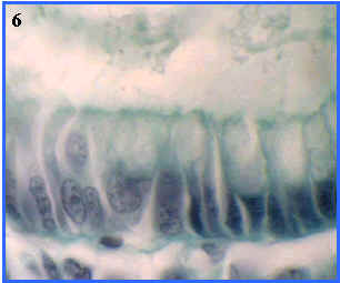 epitelio monoestratificado prismtico con microvellosidades y clulas caliciformes