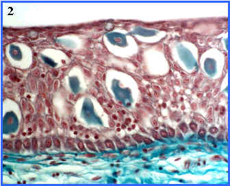 clulas de alarma: glndula unicelular intraepitelial