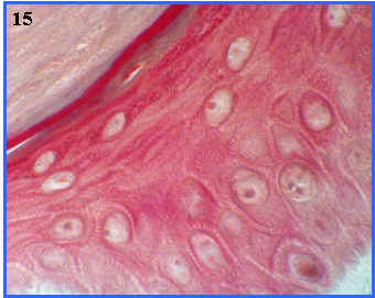 estratos de la epidermis