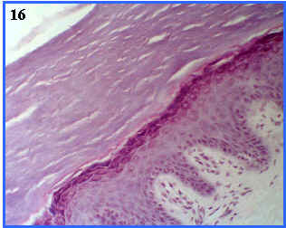 Epitelio pluriestratificado plano queratinizado