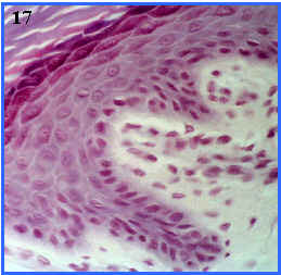 distintos estratos de la epidermis