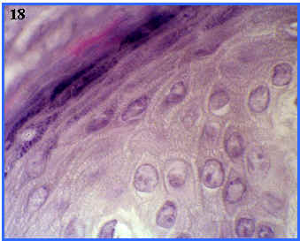 distintos estratos de la epidermis