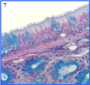 epitelio pseudoestratificado ciliado con clulas caliciformes