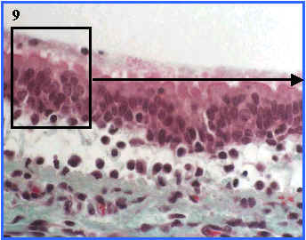 epitelio pseudoestratificado ciliado con clulas caliciformes