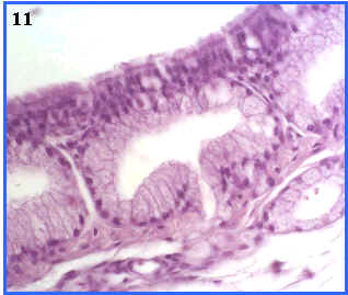 epitelio pseudoestratificado ciliado con clulas caliciformes