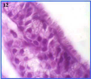 epitelio pseudoestratificado ciliado con clulas caliciformes