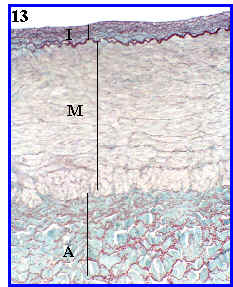 arteria coronaria con sus capas