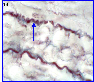 fibras elasticas