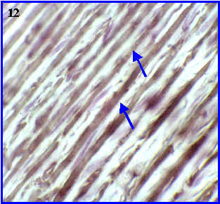 Fibras elsticas en arteria aorta