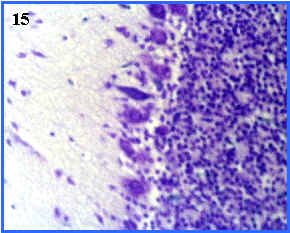 Neuronas de Purkinje