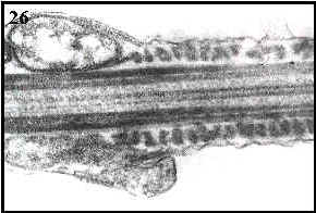 flagelo (cola de espermatozoide en longitud) 