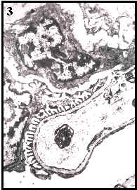 epitelio monoestratificado y plano