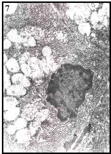 acino mucoso en glndula sublingual humana