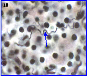 Fibras reticulares en hgado