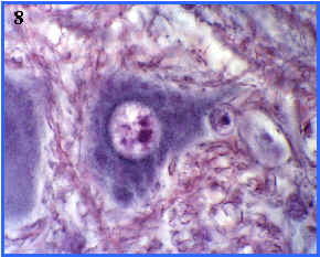 neuronas: grnulos de Nissl