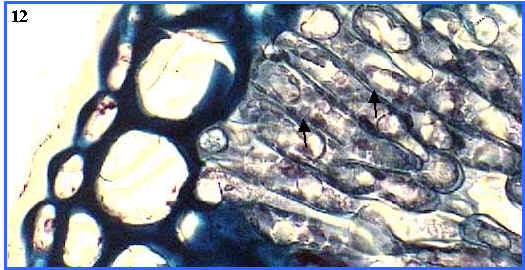 parnquima fotosinttico (cloroplastos)