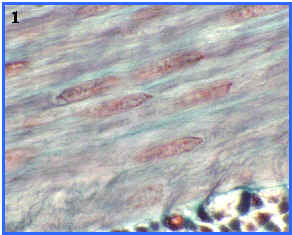 Msculo liso (seccin longitudinal)