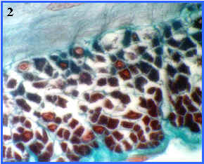 Msculo liso (seccin transversal)