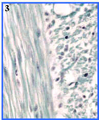 msculo liso (seccin longitudinal y transversal)