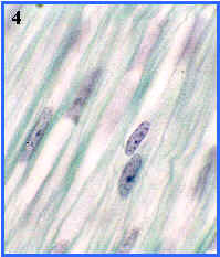 msculo liso (seccin longitudinal)