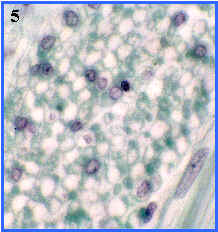 msculo liso (seccin transversal)