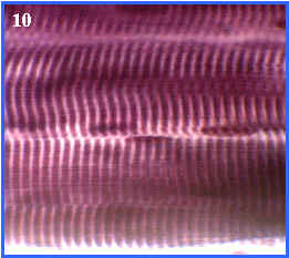 Msculo esqueltico (seccin longitudinal)