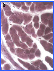 Msculo esqueltico (seccin ltransversal)