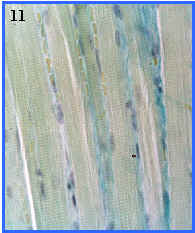 Msculo esqueltico (seccin longitudinal)