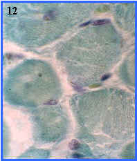 Msculo esqueltico (seccin transversal)