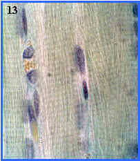 Msculo esqueltico (seccin longitudinal)