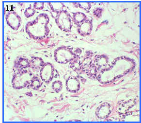 Glndula apocrina