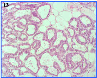 Glndula de secreccin apocrina