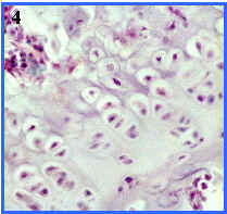 zonas de osificacin endocondral