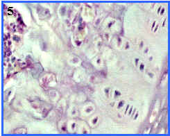 zonas de osificacin endocondral