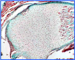 osificacin endocondral, panormica