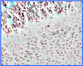 osificacin endocondral, panormica zonas