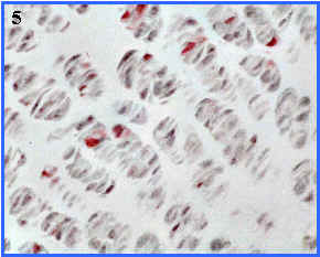 zonas osificacin endocondral