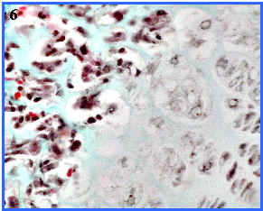 zonas osificacin endocondral