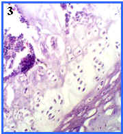 Osificacin endocondral, panormica