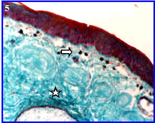 Tejido conjuntivo: laxo y denso