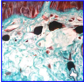 Tejido conjuntivo laxo, melanforos 