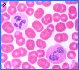 neutrfilo y eosinfilo