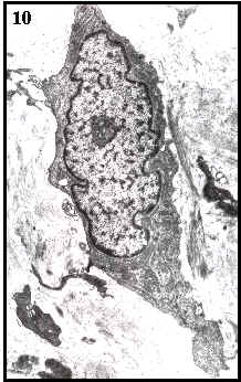 Fibroblasto