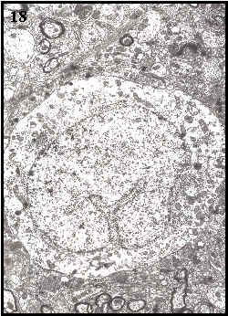 cuerpo o soma de una neurona