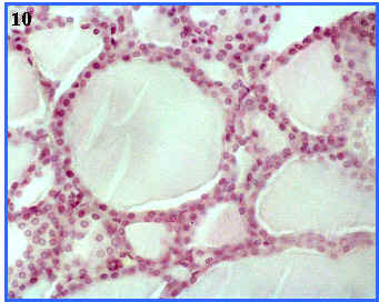 Glndula endocrina (folculos tiroideos)