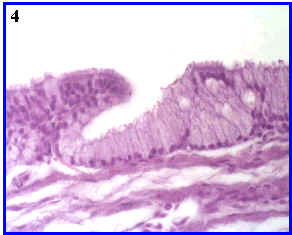 glndula intraepitelial pluricelular