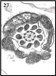 flagelo (cola espermatozoide transversal)